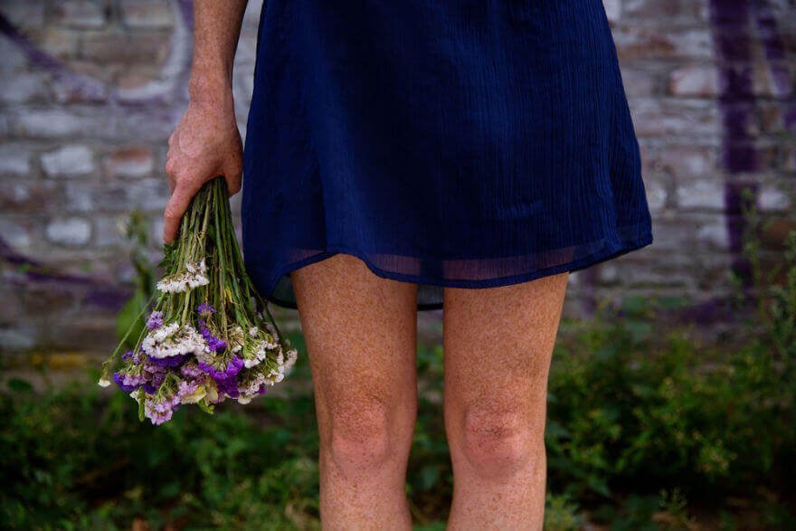 Покрытые веснушками ногами девушки из Будапешта